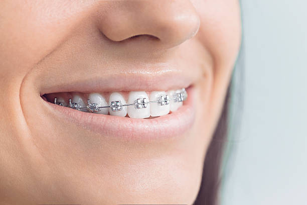 Best Dental Fillings (Composite and Amalgam)  in Combes, TX